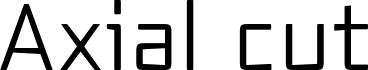 Axial cut Regular